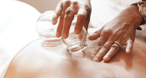 Be Well: Your Top Ten Questions about Cupping Therapy, Answered