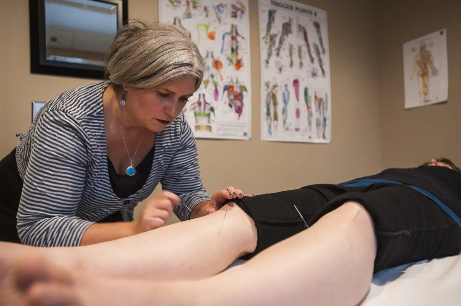 Is an Acupuncture Career Right for You? 7 Must-Ask Questions