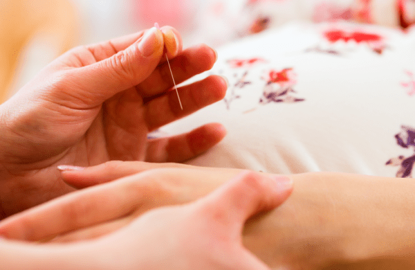 Acupuncture and Pregnancy-Related Low Back and Pelvic Pain