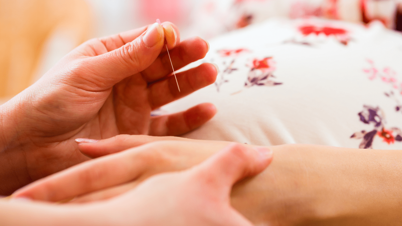 Acupuncture and Pregnancy-Related Low Back and Pelvic Pain