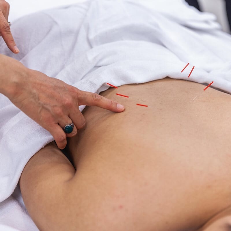 Tile Acupuncture