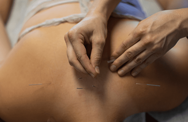 Great River Symposium: Ask the Acupuncture Expert