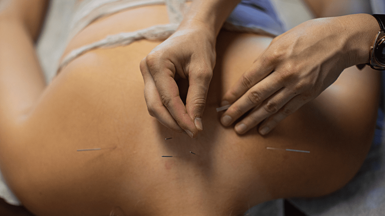 Great River Symposium: Ask the Acupuncture Expert