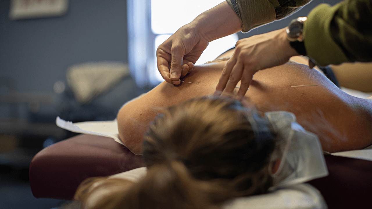 New: Student Acupuncture Packages at Bloomington Clinic