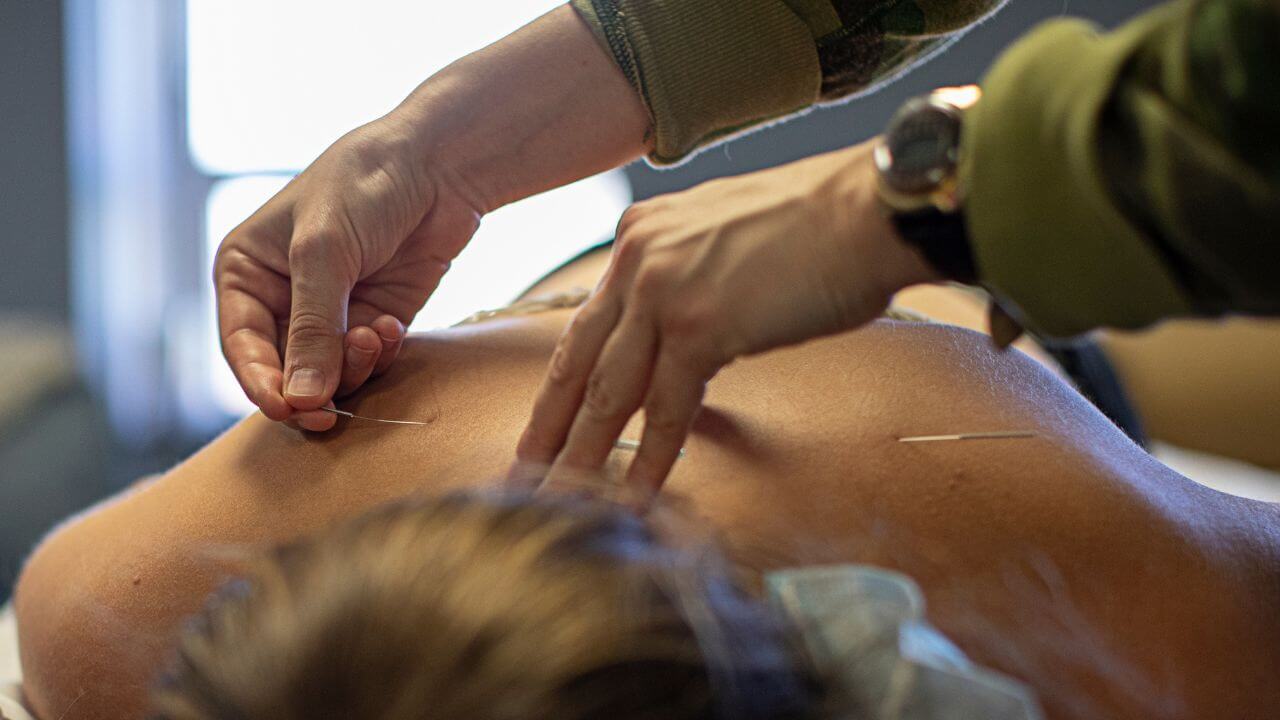 Blog Looking At Acupuncture Schools Make Sure Minnesota Is On Your List (1)